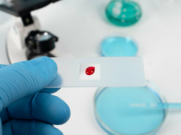 Безплатни тестове за ХИВ, хепатит и сифилис